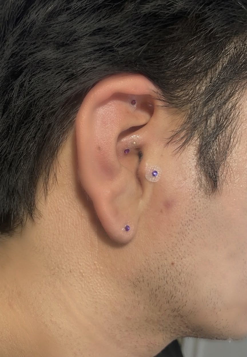 Auriculoterapia